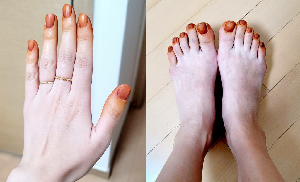 추억의봉선화물들이기_손발톱_1일차