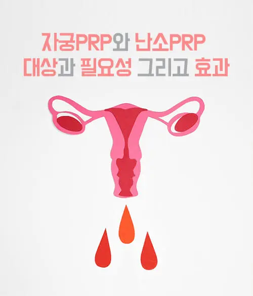 자궁PRP와-난소PRP-대상과-필요성-그리고-효과